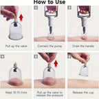 Cupping Set