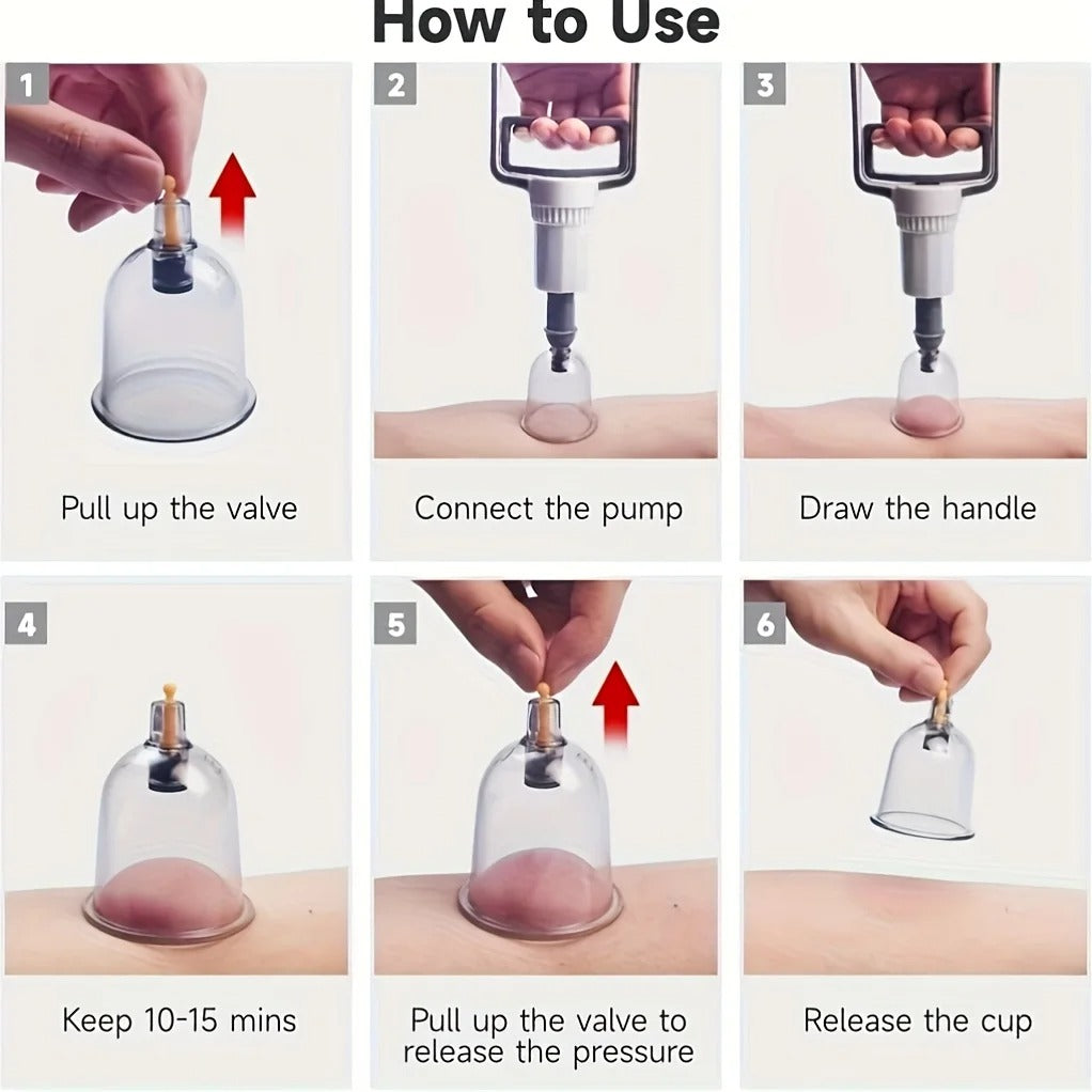 Cupping Set